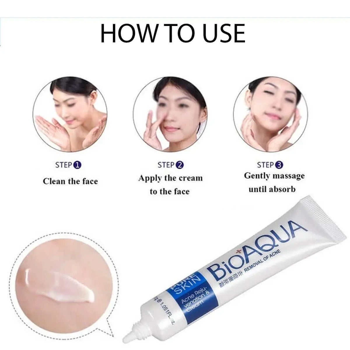 Anti Acne Cream My Store