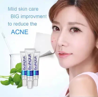 Anti Acne Cream My Store