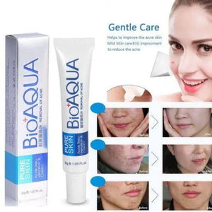 Anti Acne Cream My Store